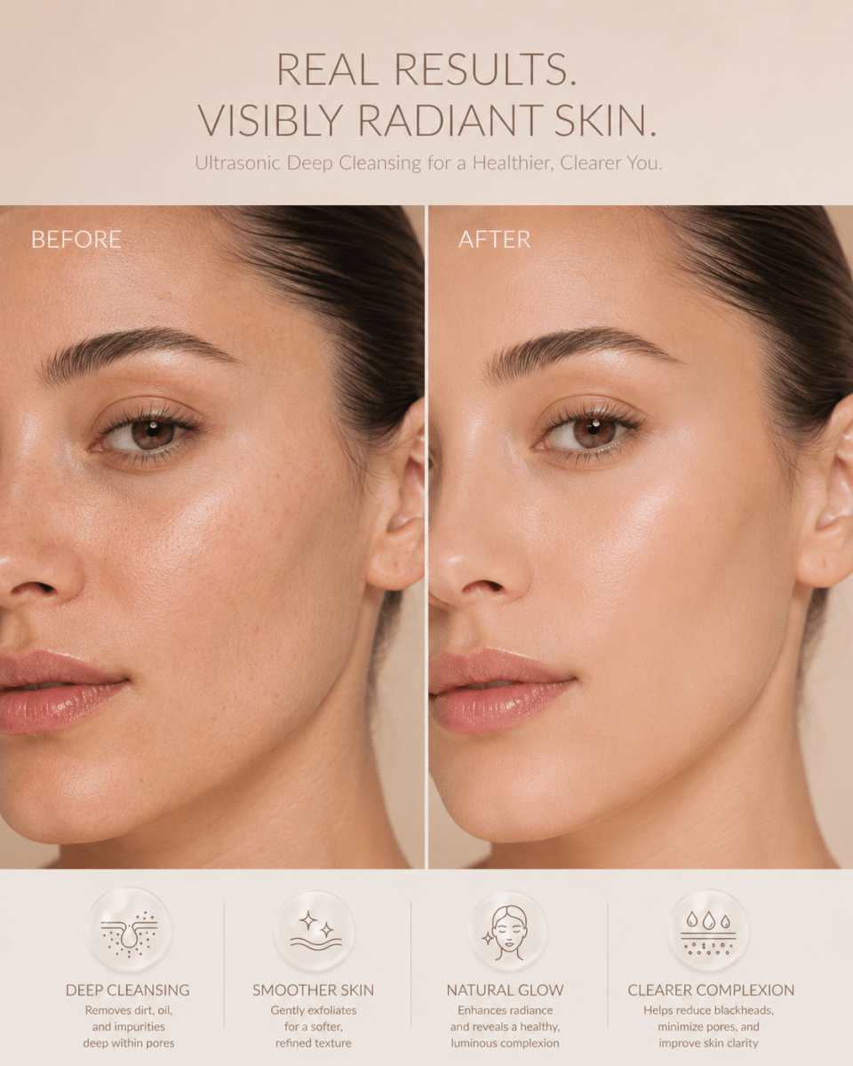 SkinRise™ Ultrasonic Pore Cleanser - SkinRise LED Facial Massager - Microcurrent Beauty Device